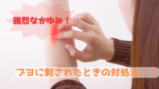 おすすめのかゆみ止め